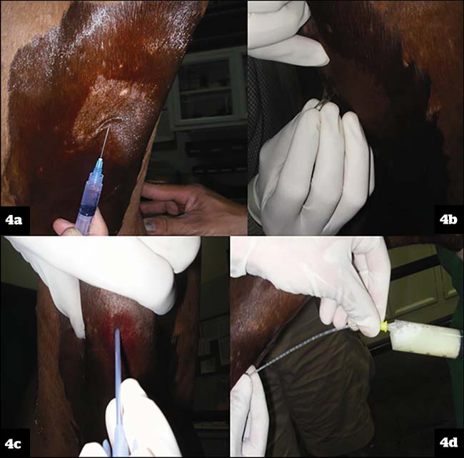 Figure 4a. Placing a subcutaneous bleb of local anaesthetic for the percutaneous tracheal aspirate. 4b. Stab incision is made through the skin and subcutaneous tissue with a number 15 scalpel blade. 4c. The catheter is introduced into the tracheal lumen between two cartilage rings. 4d. Sample aspirated aseptically.