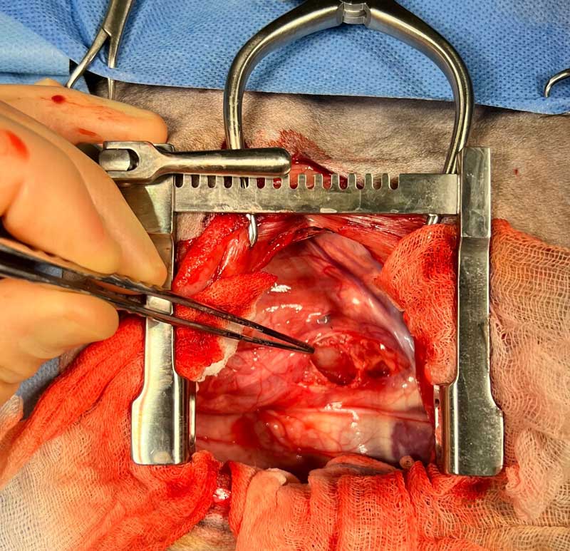 The ligament has been ligated and divided. The underlying oesophageal wall is now visible (forceps) and a wide bore orogastric tube has been introduced to remove any residual fibrotic constriction.