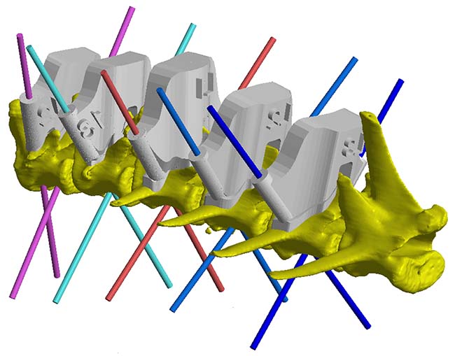 Computer-aided design view of thoracolumbar junction (T12 to L4) with drill guides in situ and pilot hole trajectories planned across. Image © Vet3D / www.vet3D.co.uk