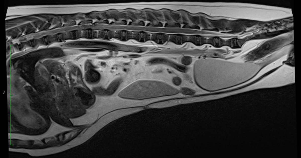 T2-weighted sagittal MRI scan.