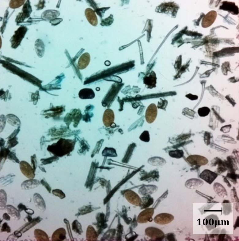 Figure 1. Eggs of Fasciola hepatica (golden) and Calicophoron daubneyi (colourless), imaged using the Micro-I 100.