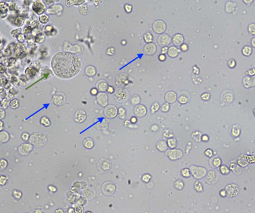 Figure 1. Urine sediment from a dog, unstained preparation (Wright-Giemsa, 40×).