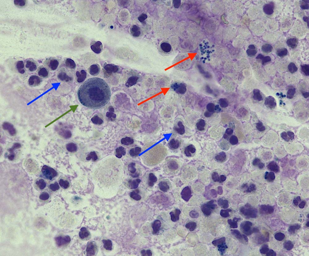 Figure 2. Stained urine sediment from a dog (Wright-Giemsa, 40×).