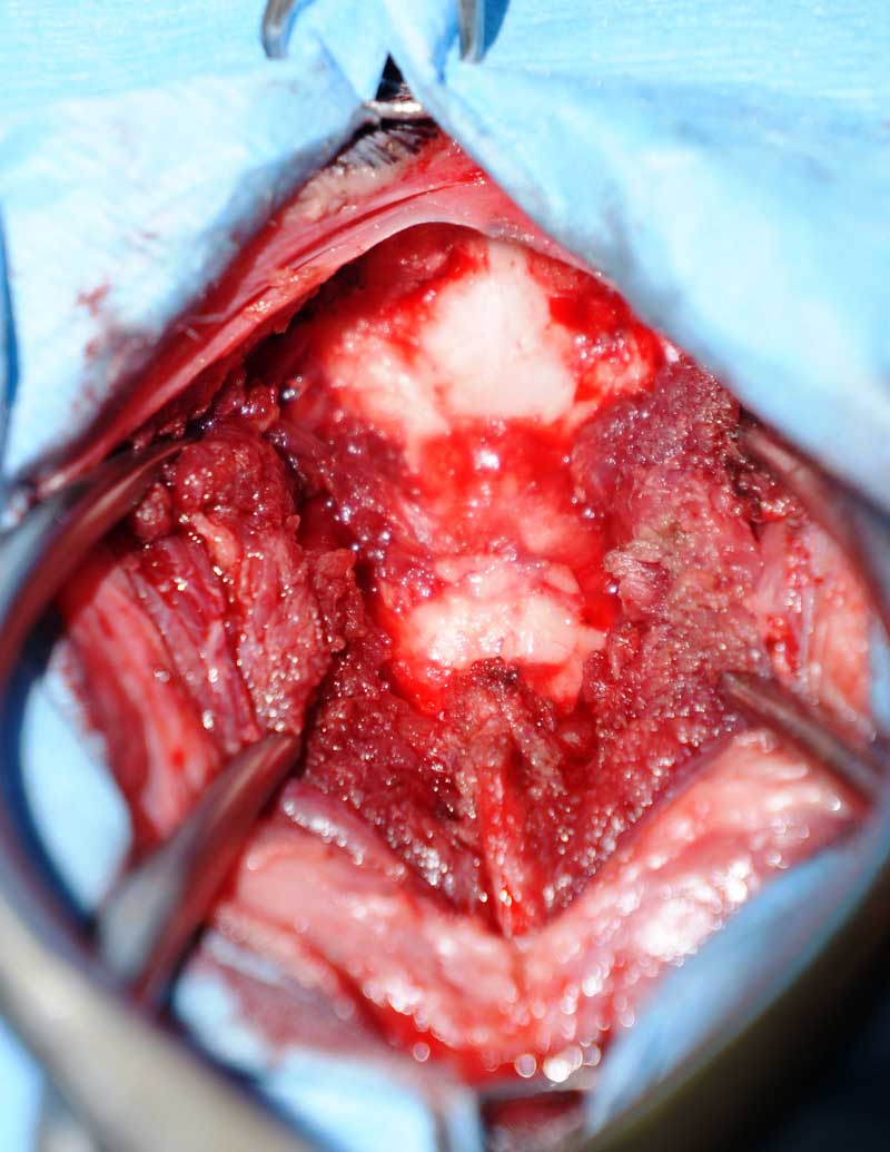 Figure 6. Surgical approach.