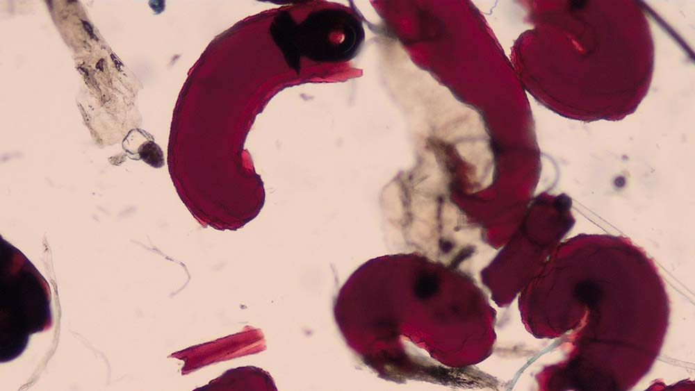 Figure 1 (above). Flea faeces found on a coat brushing of a dog.