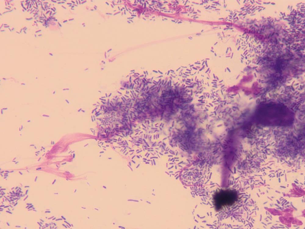 Figure 11. An ear smear from a dog with Pseudomonas species otitis. Note the large numbers of rod-shaped bacteria.