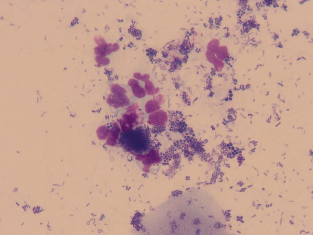 Figure 12. An ear smear from a dog with a mixed bacterial infection.