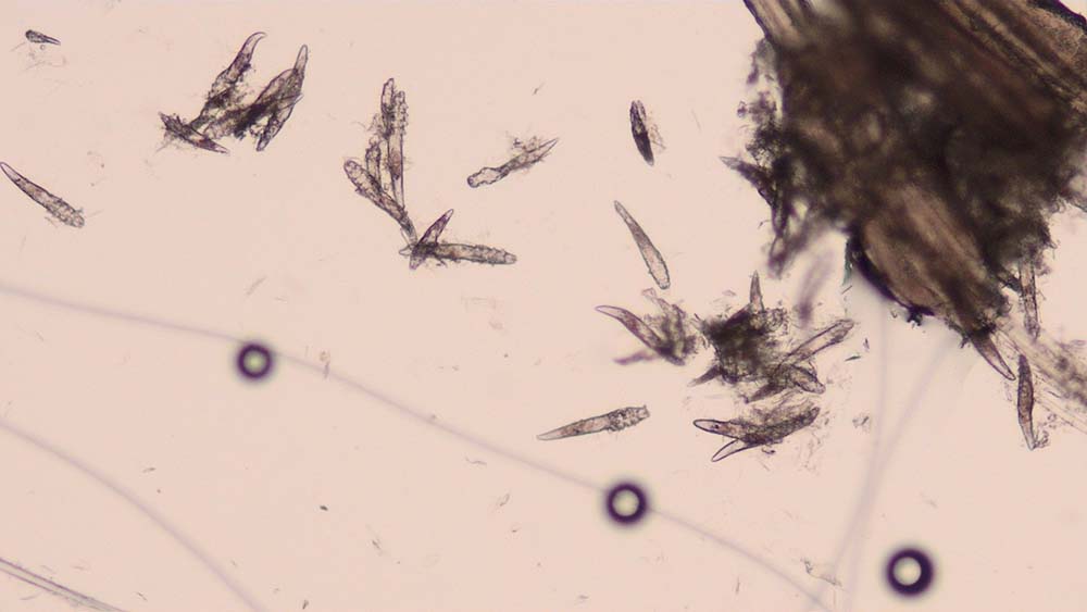 Figure 3. Demodex species mites in a skin scraping from a dog. 