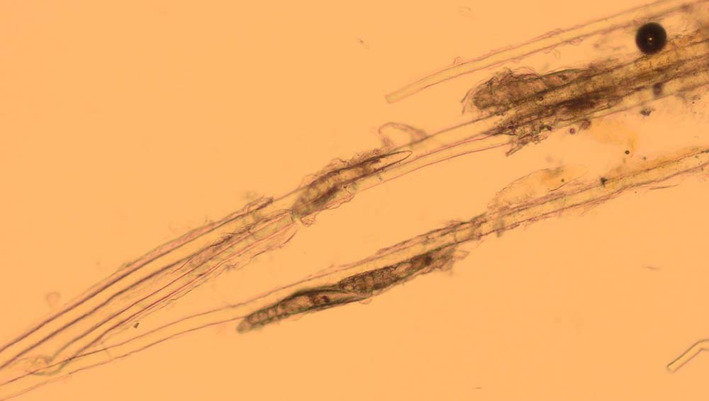 Figure 5. Demodex canis found on hair plucks from a dog.