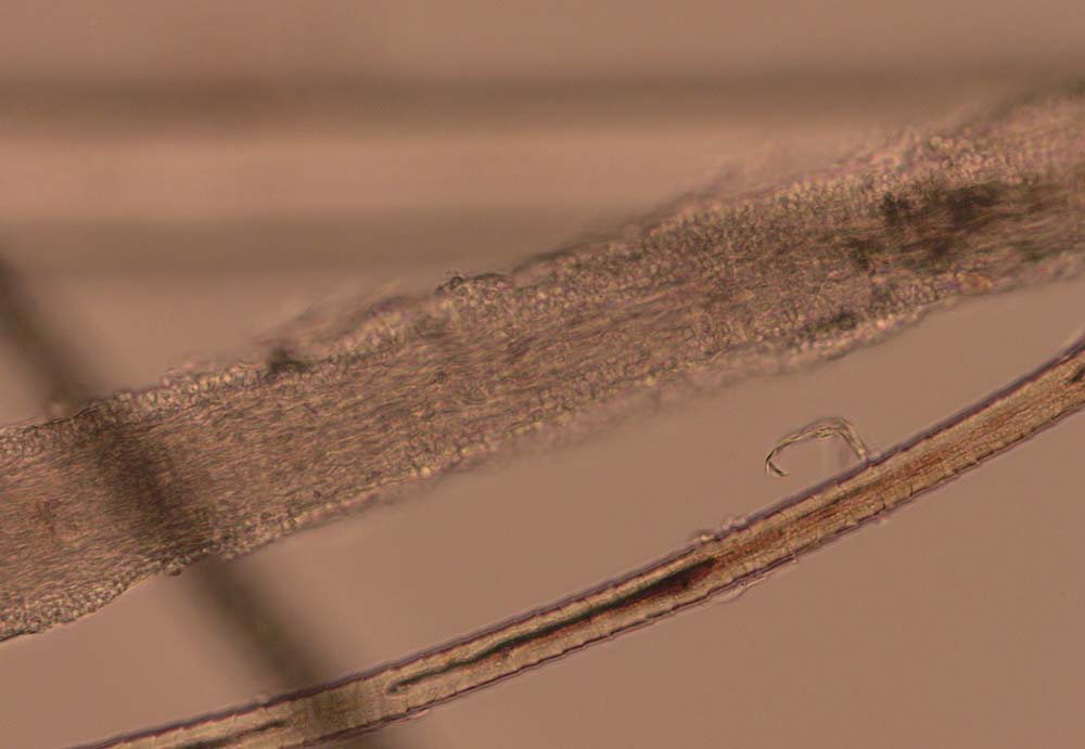 Figure 6. An enlarged and “fuzzy”-appearing hair shaft in dermatophytosis. The hyphae can be seen within the hair shaft and arthrospores are present on the surface. The hair shaft has lost the normal corticomedullary definition.