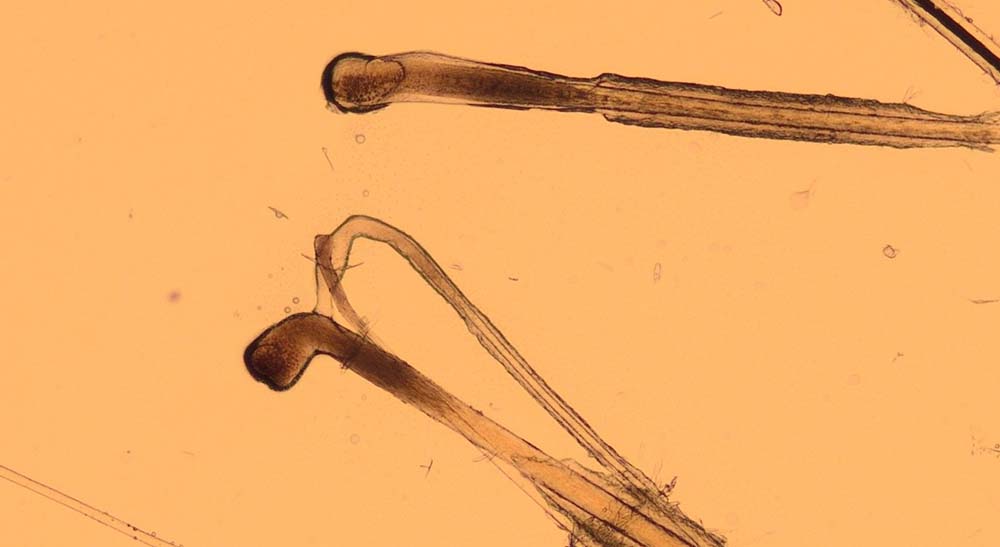 Figure 7. Hair plucks showing anagen (actively growing) hairs. The bulbs are pigmented and rounded, and the hairs are surrounded by an inner root sheath.