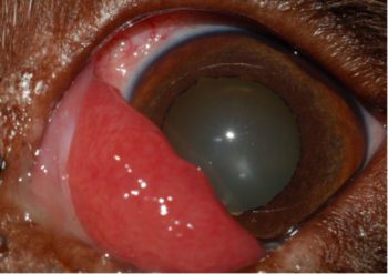 Figure 2. Prolapsed third eyelid in an eight-year-old English springer spaniel, presenting three weeks after initial prolapse.