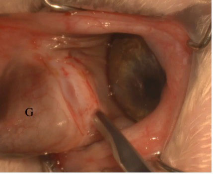 Figure 4b. Incision posterior to the prolapsed gland labelled “G”.