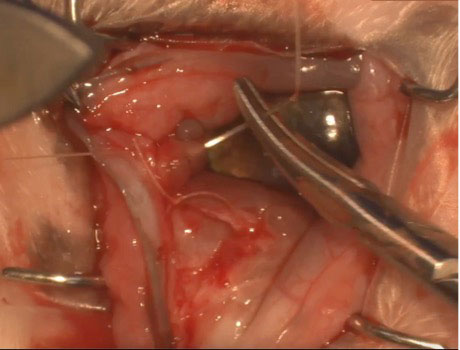 Figure 6a. 6-0 polyglactin absorbable suture being placed in a simple continuous fashion from proximal along the conjunctival incision.