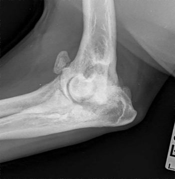 Figure 4a. Mediolateral radiographic projections of the elbow of a five-year-old male Labrador retriever, demonstrating periarticular mineralisation apparent, in addition to a large mineral fragment present cranial to the joint.
