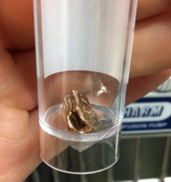 Figure 3. The zip foreign body after successful retrieval. 