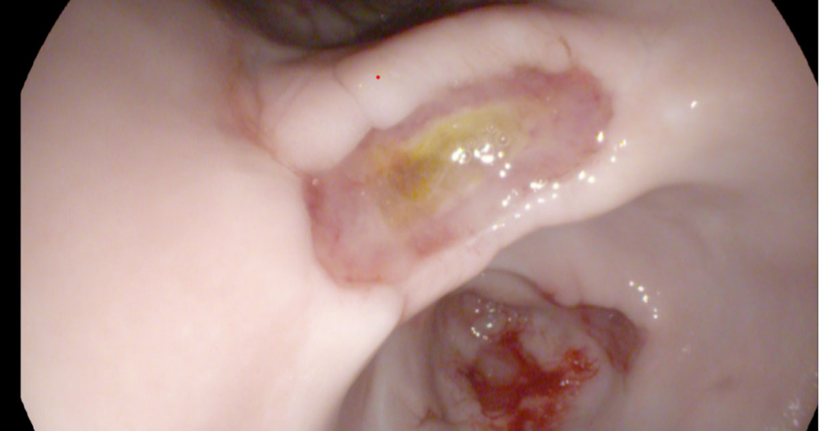 Figure 1. Ulcers in the one-year-old French bulldog.