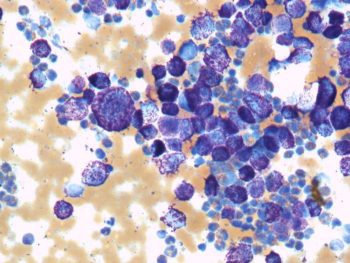 Figure 2. Spleen cytology in a dog (Wright-Giemsa 50×).