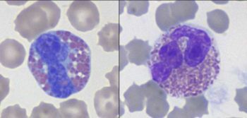 Figure 3. Canine eosinophil (left) and feline eosinophil (right; Wright-Giemsa 100×).