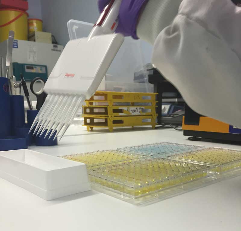 ELISA test under way. Image: Austin Davis Biologics