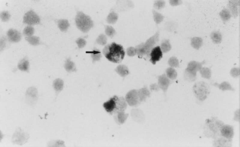 Figure 2. Coxiella burnetii microscopy.
