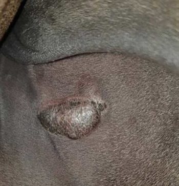 Figure 3. Nodular sarcoid on the inner thigh of a horse.
