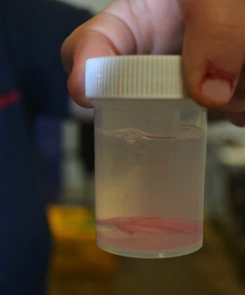 Figure 3. Retained sections of excised vas deferens in a labelled formalin pot for storage.