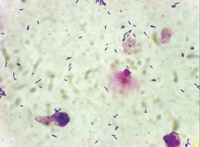 Нитриты обнаружены. Микроскопия мочи бактерии. Нитраты в моче. Нитриты в моче микроскопия. Нитриты микроскоп.